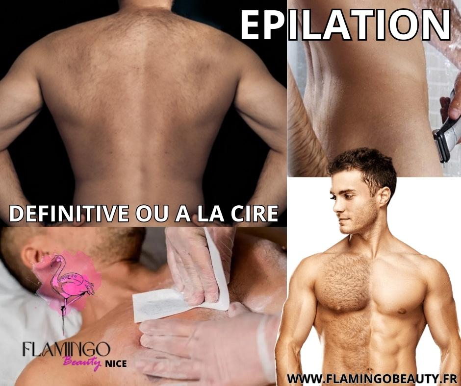 Epilation cire a nice homme