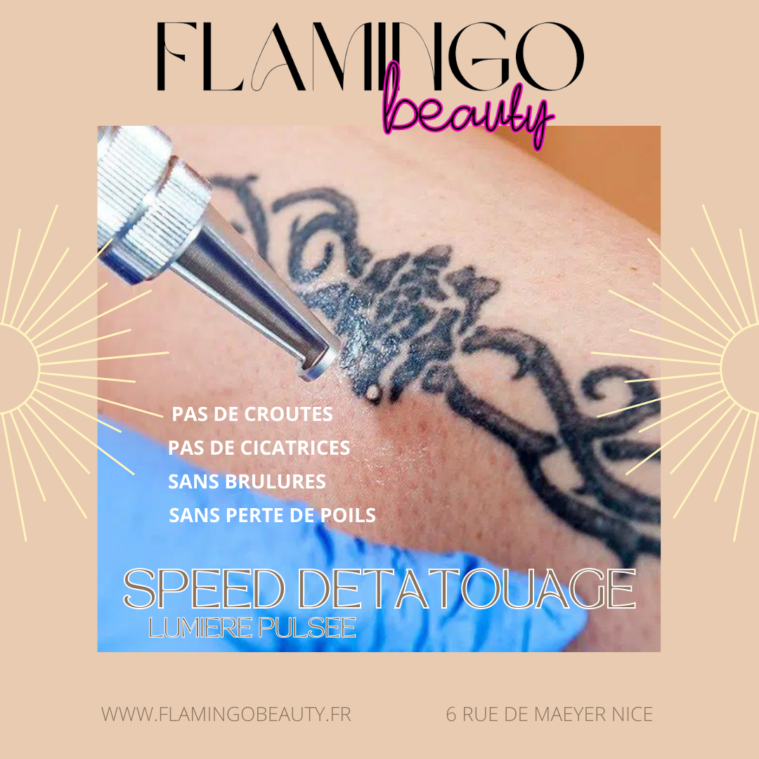 Speed detatouage NICE