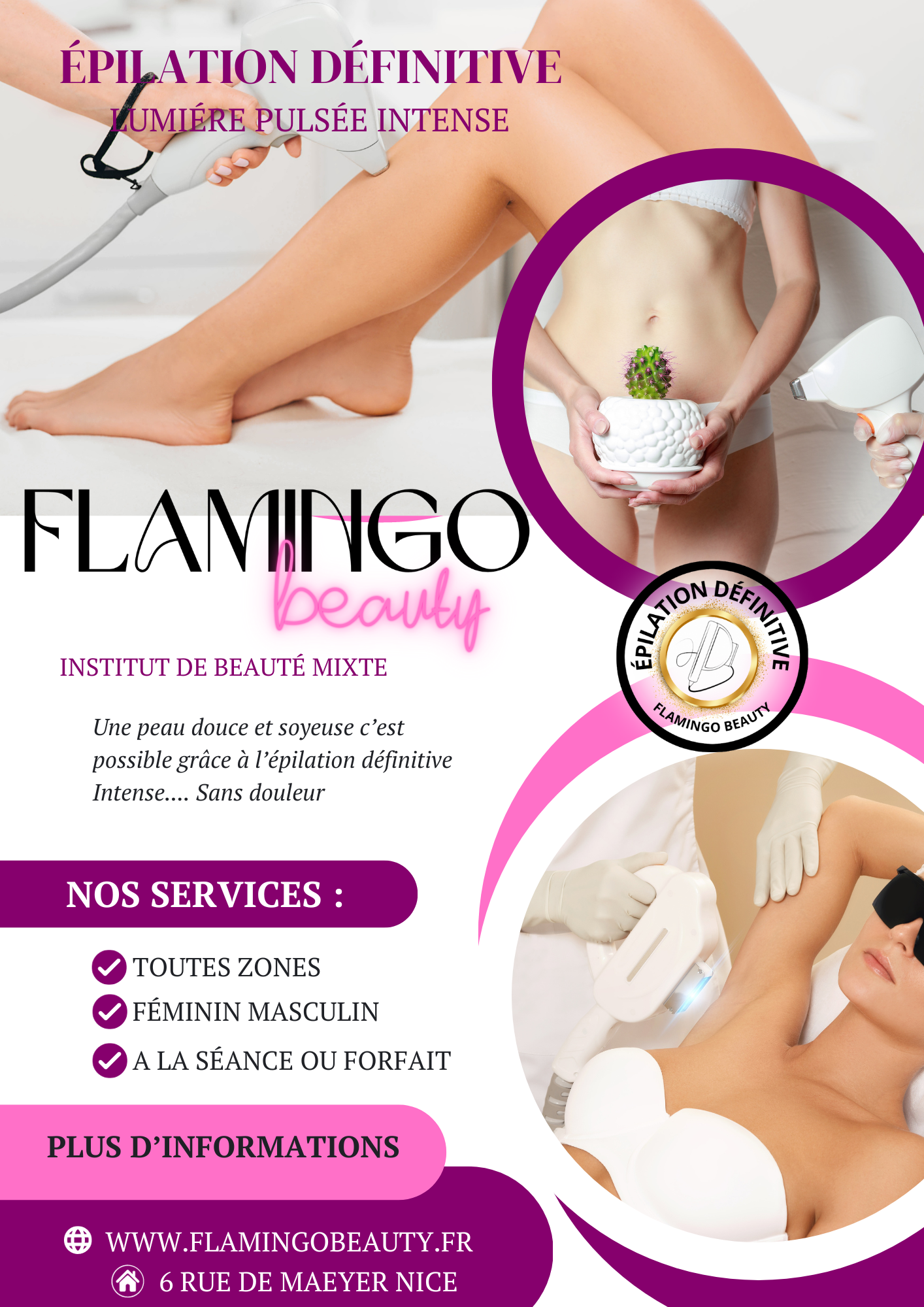 EPILATION DEFINITIVE TARIFS NICE