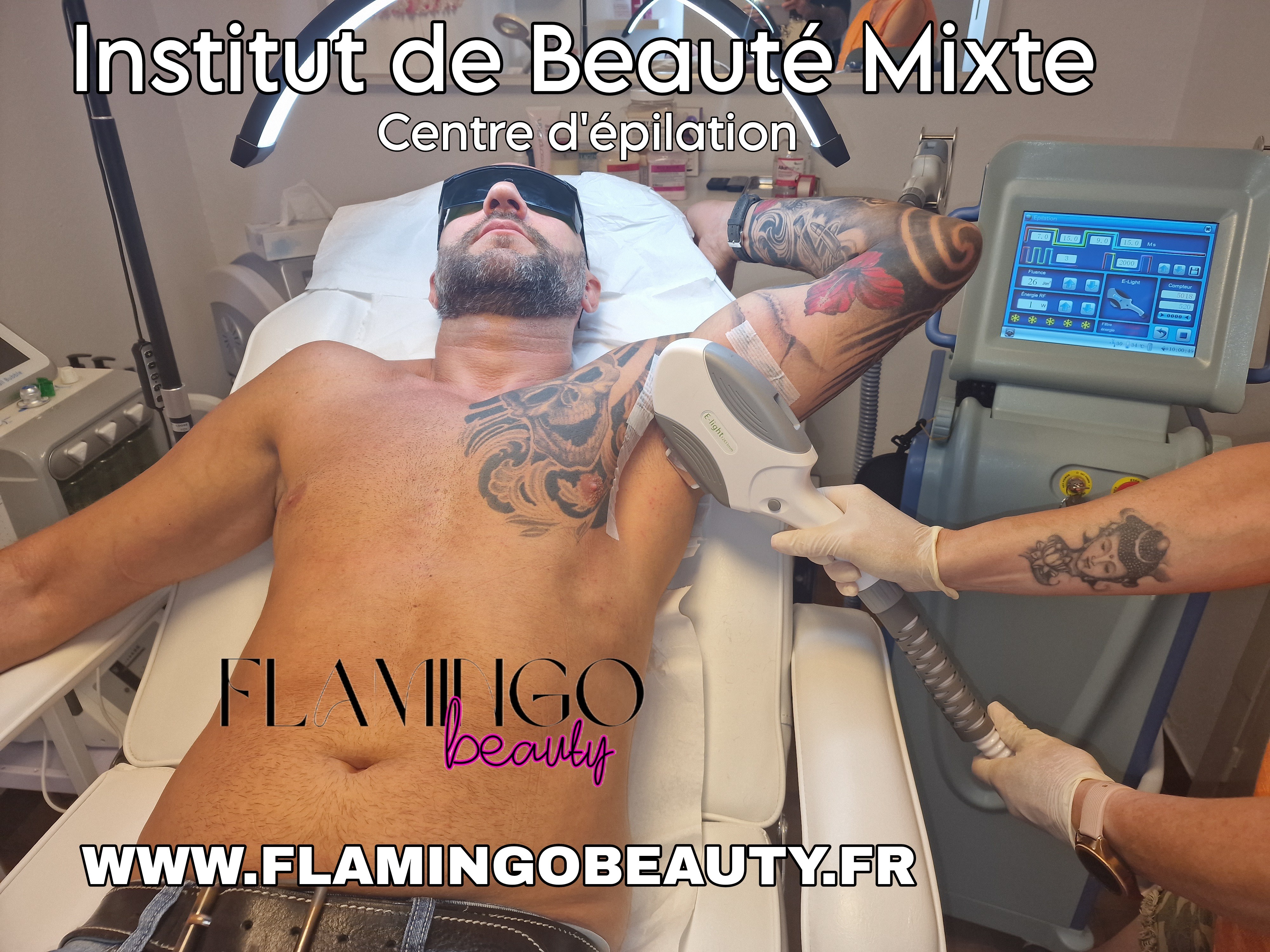 Epilation définitive Nice - Hommes, sportifs, bodybuilder....