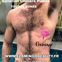 Epilation Hommes à Nice - Male Intimate Waxing