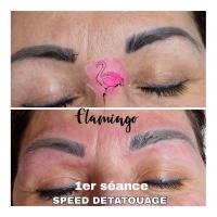 détatouage sourcils 1er séance