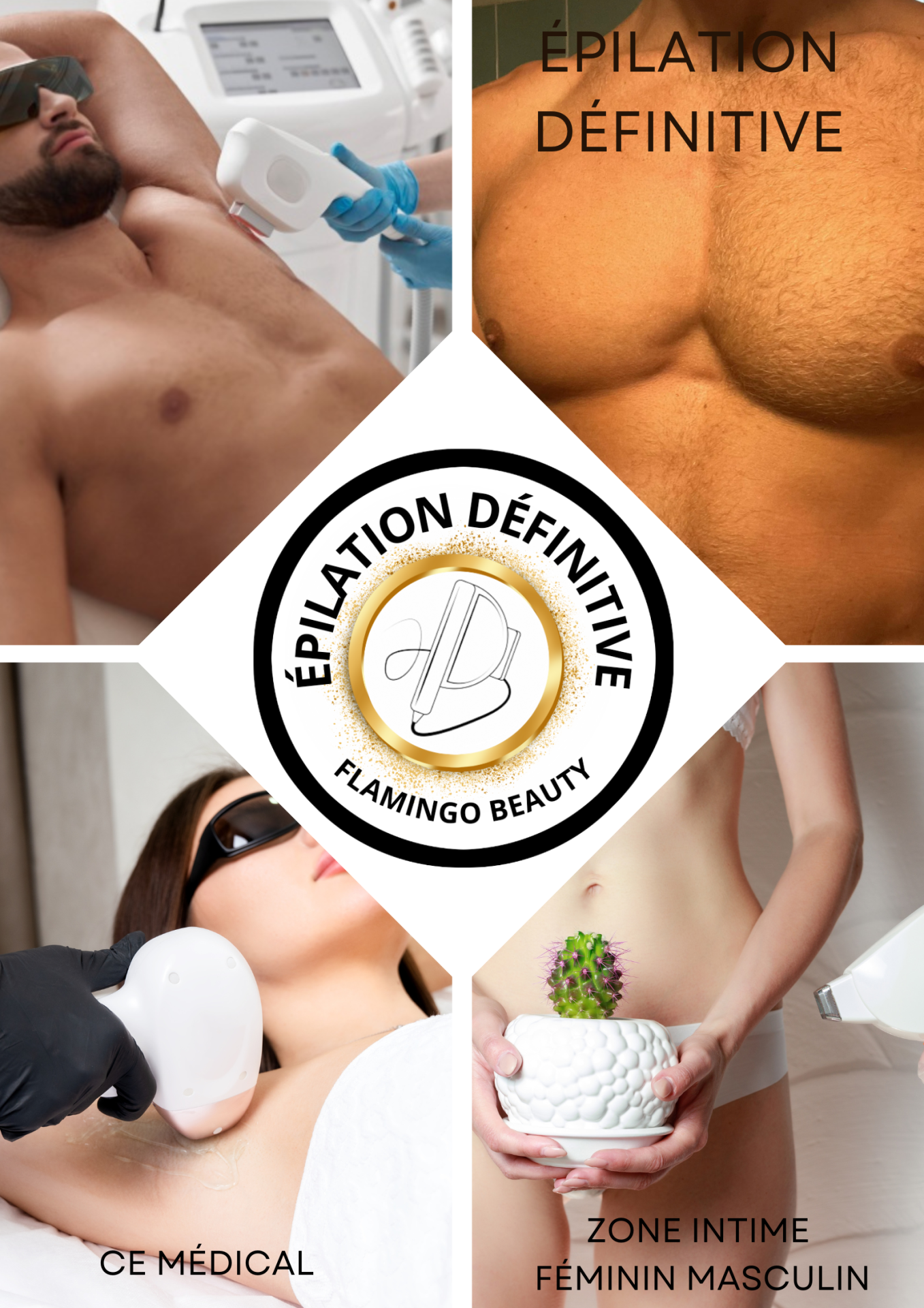 Epilation Définitive Nice maillot dos fesses feminin masculin